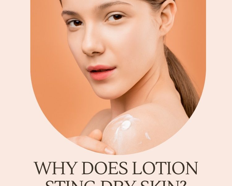 Why Does Lotion Sting Dry Skin