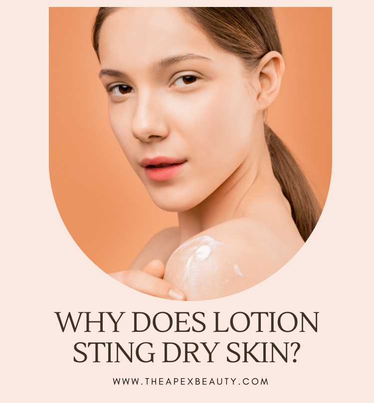 Why Does Lotion Sting Dry Skin